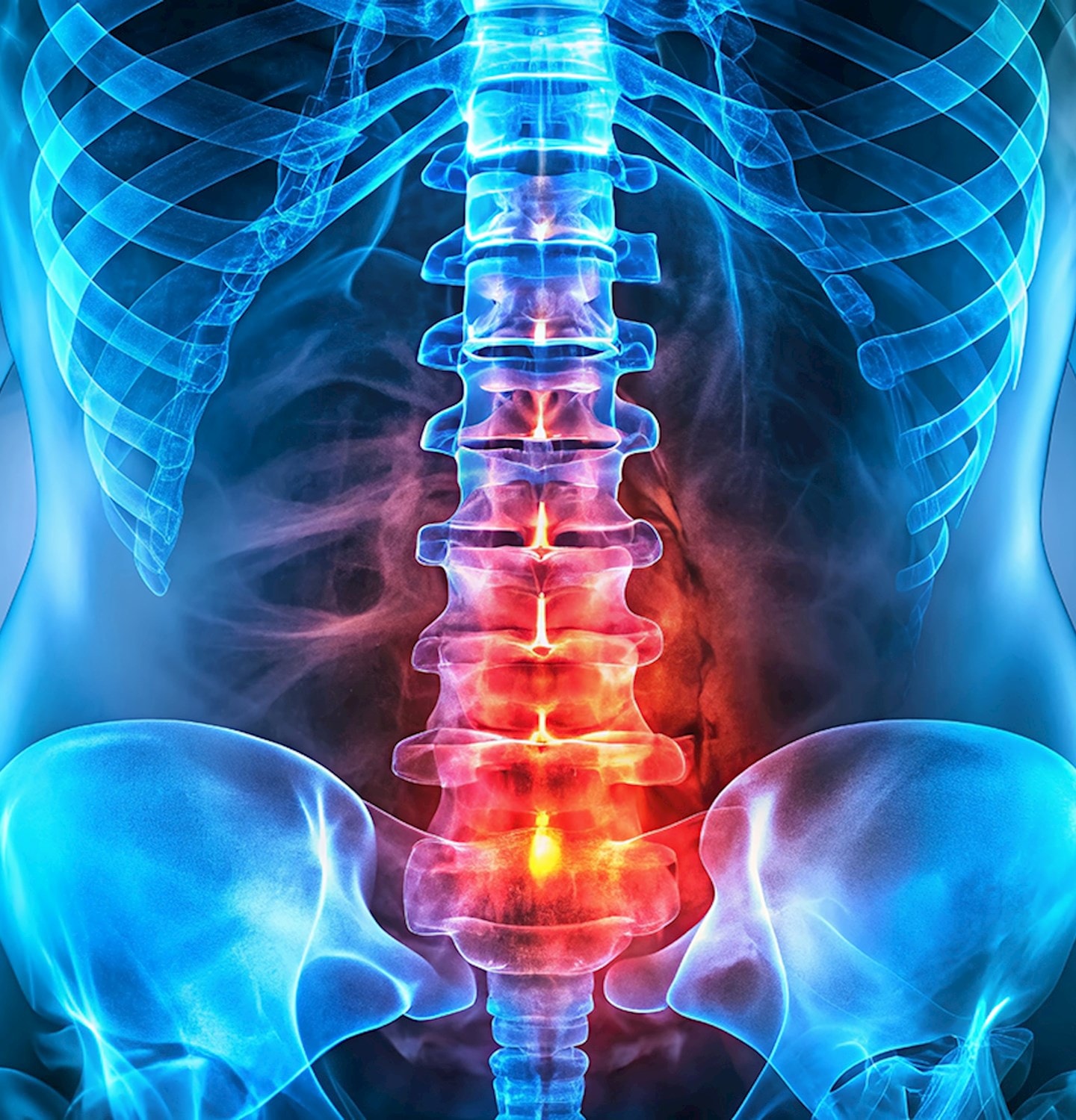 Musculoskeletal Health and Rehabilitation Research Group | Research ...